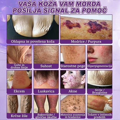 Izdelano in poslano iz Evrope ✨ 𝐆𝐎𝐋𝐃𝐊𝐈𝐒𝐒® 𝐆𝐇𝐊-𝐂𝐮 & 𝐁𝐈𝐎𝐓𝐈𝐍 𝟏𝟎-𝐁-𝟏 Obnavljajoča krema za kožo ⚡
