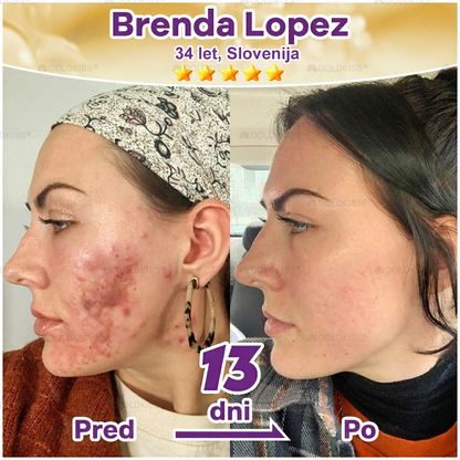 Izdelano in poslano iz Evrope ✨ 𝐆𝐎𝐋𝐃𝐊𝐈𝐒𝐒® 𝐆𝐇𝐊-𝐂𝐮 & 𝐁𝐈𝐎𝐓𝐈𝐍 𝟏𝟎-𝐁-𝟏 Obnavljajoča krema za kožo ⚡