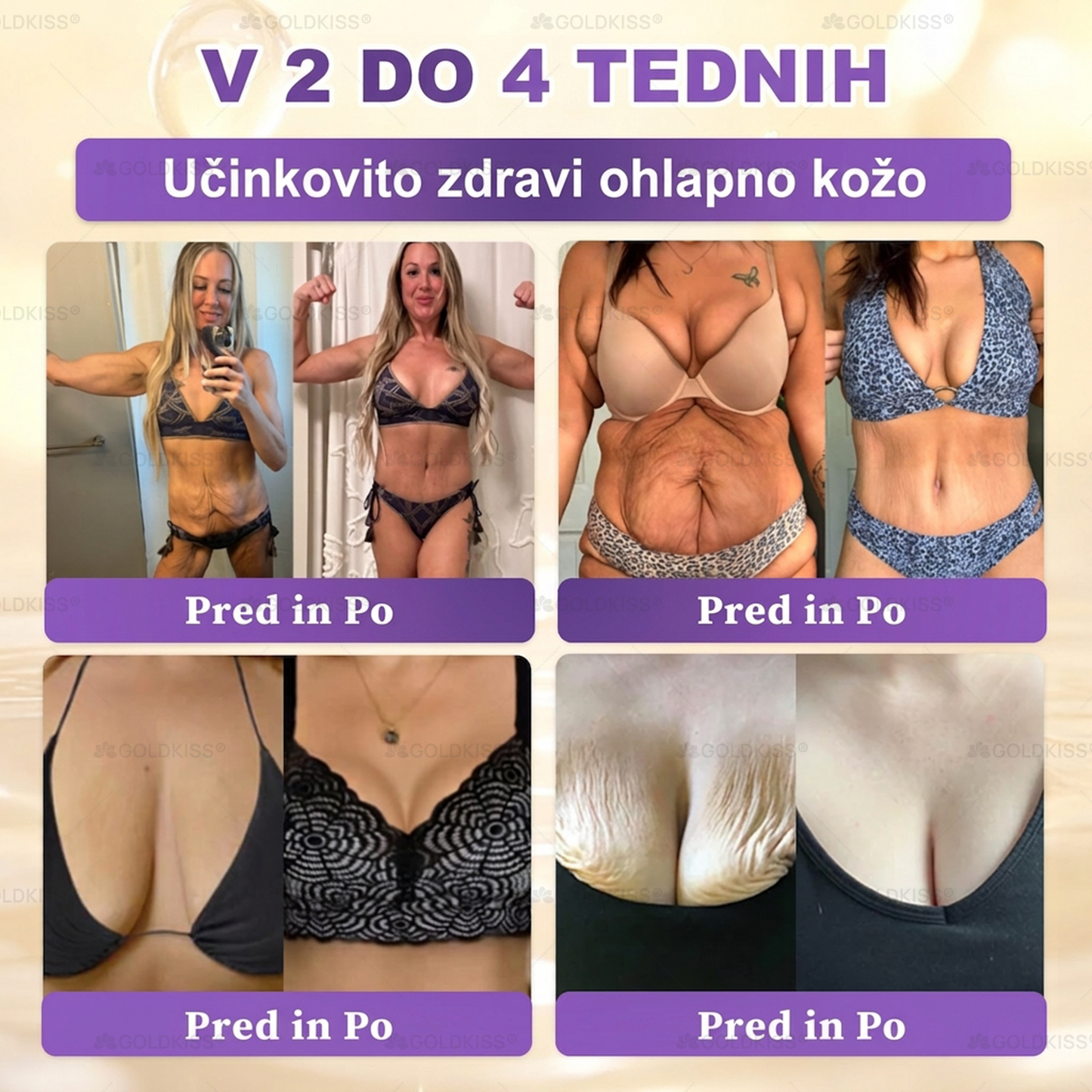 Izdelano in poslano iz Evrope ✨ 𝐆𝐎𝐋𝐃𝐊𝐈𝐒𝐒® 𝐆𝐇𝐊-𝐂𝐮 & 𝐁𝐈𝐎𝐓𝐈𝐍 𝟏𝟎-𝐁-𝟏 Obnavljajoča krema za kožo ⚡