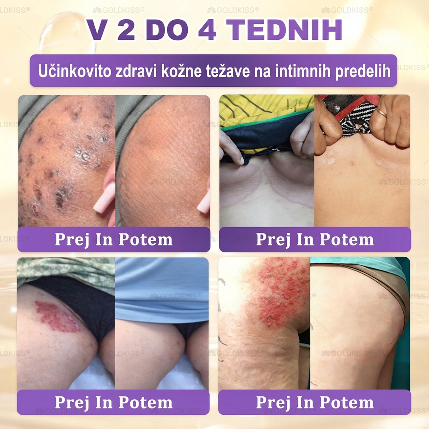 Izdelano in poslano iz Evrope ✨ 𝐆𝐎𝐋𝐃𝐊𝐈𝐒𝐒® 𝐆𝐇𝐊-𝐂𝐮 & 𝐁𝐈𝐎𝐓𝐈𝐍 𝟏𝟎-𝐁-𝟏 Obnavljajoča krema za kožo ⚡
