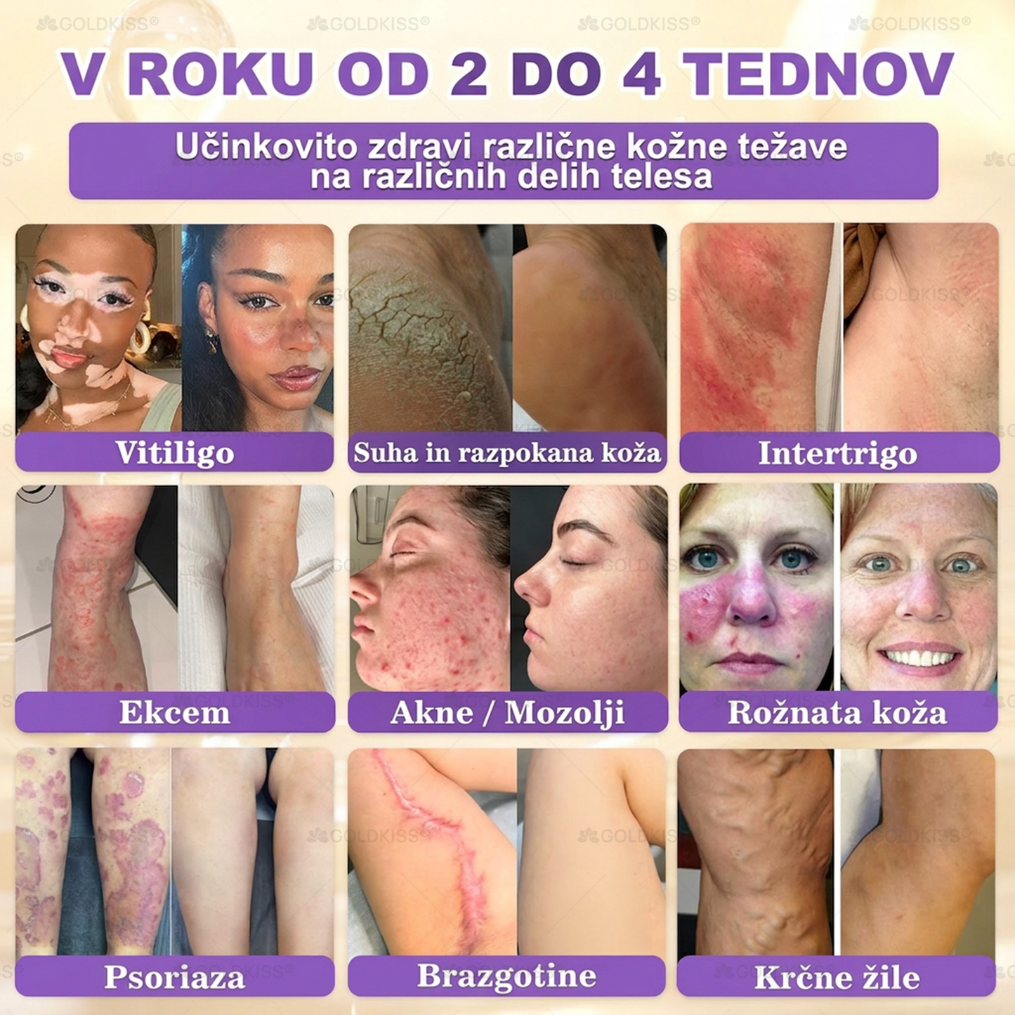 Izdelano in poslano iz Evrope ✨ 𝐆𝐎𝐋𝐃𝐊𝐈𝐒𝐒® 𝐆𝐇𝐊-𝐂𝐮 & 𝐁𝐈𝐎𝐓𝐈𝐍 𝟏𝟎-𝐁-𝟏 Obnavljajoča krema za kožo ⚡
