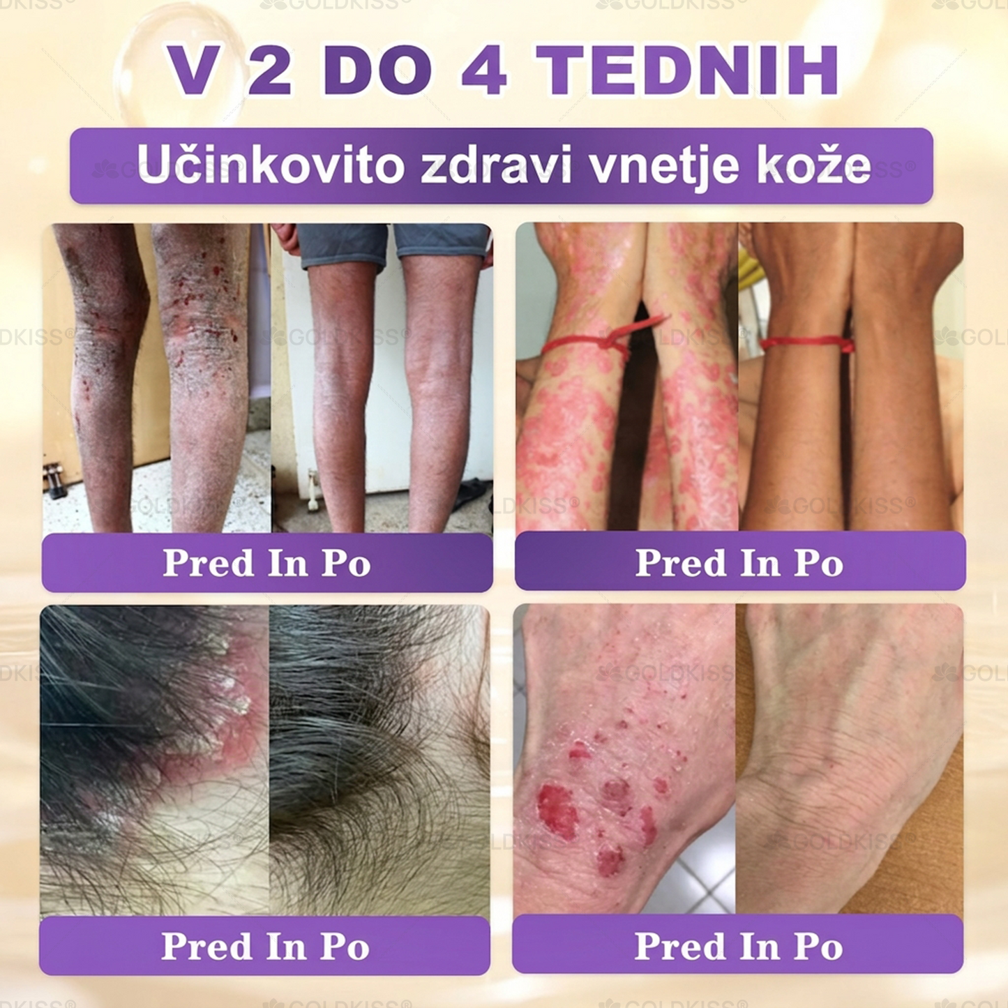 Izdelano in poslano iz Evrope ✨ 𝐆𝐎𝐋𝐃𝐊𝐈𝐒𝐒® 𝐆𝐇𝐊-𝐂𝐮 & 𝐁𝐈𝐎𝐓𝐈𝐍 𝟏𝟎-𝐁-𝟏 Obnavljajoča krema za kožo ⚡