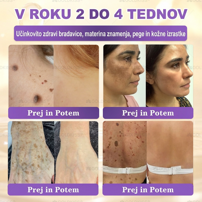Izdelano in poslano iz Evrope ✨ 𝐆𝐎𝐋𝐃𝐊𝐈𝐒𝐒® 𝐆𝐇𝐊-𝐂𝐮 & 𝐁𝐈𝐎𝐓𝐈𝐍 𝟏𝟎-𝐁-𝟏 Obnavljajoča krema za kožo ⚡