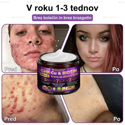 Izdelano in poslano iz Evrope ✨ 𝐆𝐎𝐋𝐃𝐊𝐈𝐒𝐒® 𝐆𝐇𝐊-𝐂𝐮 & 𝐁𝐈𝐎𝐓𝐈𝐍 𝟏𝟎-𝐁-𝟏 Obnavljajoča krema za kožo ⚡