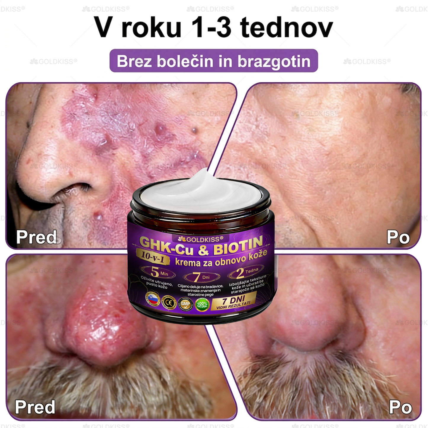 Izdelano in poslano iz Evrope ✨ 𝐆𝐎𝐋𝐃𝐊𝐈𝐒𝐒® 𝐆𝐇𝐊-𝐂𝐮 & 𝐁𝐈𝐎𝐓𝐈𝐍 𝟏𝟎-𝐁-𝟏 Obnavljajoča krema za kožo ⚡