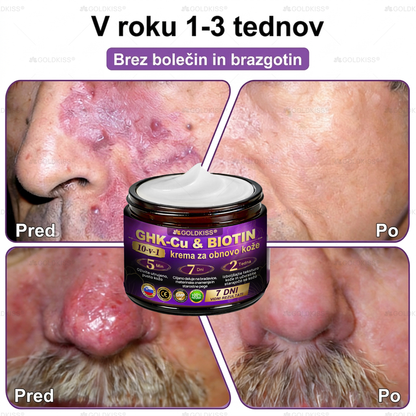 Izdelano in poslano iz Evrope ✨ 𝐆𝐎𝐋𝐃𝐊𝐈𝐒𝐒® 𝐆𝐇𝐊-𝐂𝐮 & 𝐁𝐈𝐎𝐓𝐈𝐍 𝟏𝟎-𝐁-𝟏 Obnavljajoča krema za kožo ⚡