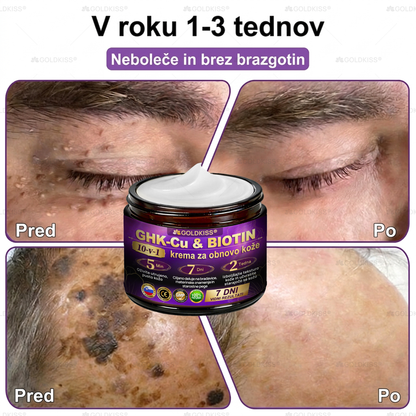 Izdelano in poslano iz Evrope ✨ 𝐆𝐎𝐋𝐃𝐊𝐈𝐒𝐒® 𝐆𝐇𝐊-𝐂𝐮 & 𝐁𝐈𝐎𝐓𝐈𝐍 𝟏𝟎-𝐁-𝟏 Obnavljajoča krema za kožo ⚡