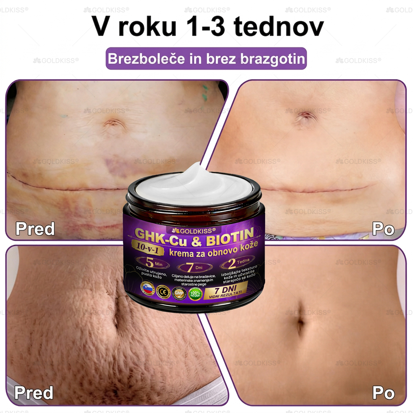 Izdelano in poslano iz Evrope ✨ 𝐆𝐎𝐋𝐃𝐊𝐈𝐒𝐒® 𝐆𝐇𝐊-𝐂𝐮 & 𝐁𝐈𝐎𝐓𝐈𝐍 𝟏𝟎-𝐁-𝟏 Obnavljajoča krema za kožo ⚡