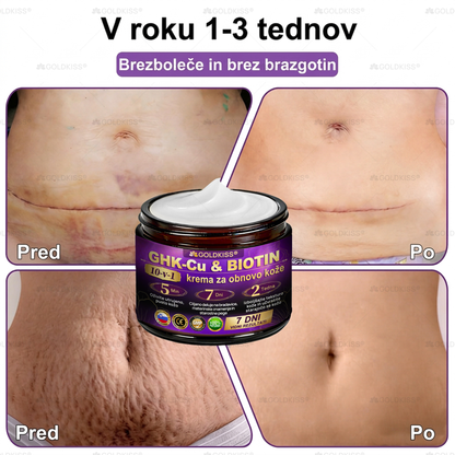 Izdelano in poslano iz Evrope ✨ 𝐆𝐎𝐋𝐃𝐊𝐈𝐒𝐒® 𝐆𝐇𝐊-𝐂𝐮 & 𝐁𝐈𝐎𝐓𝐈𝐍 𝟏𝟎-𝐁-𝟏 Obnavljajoča krema za kožo ⚡