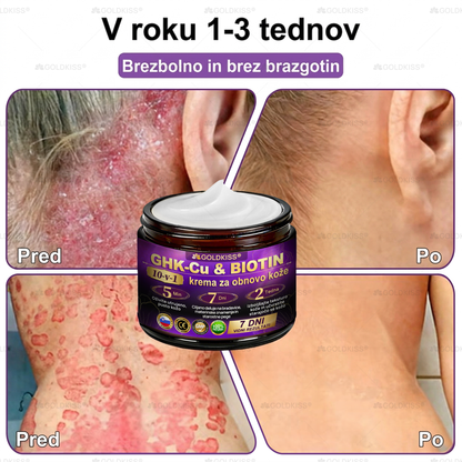 Izdelano in poslano iz Evrope ✨ 𝐆𝐎𝐋𝐃𝐊𝐈𝐒𝐒® 𝐆𝐇𝐊-𝐂𝐮 & 𝐁𝐈𝐎𝐓𝐈𝐍 𝟏𝟎-𝐁-𝟏 Obnavljajoča krema za kožo ⚡